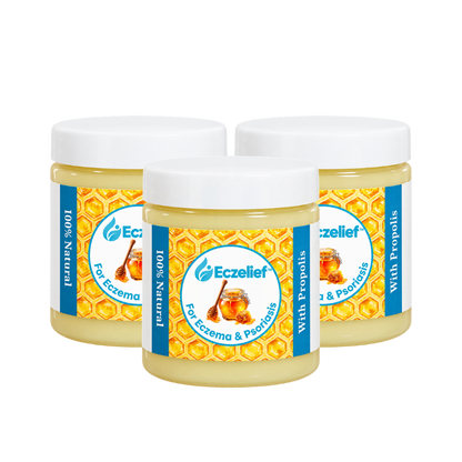 Eczelief™